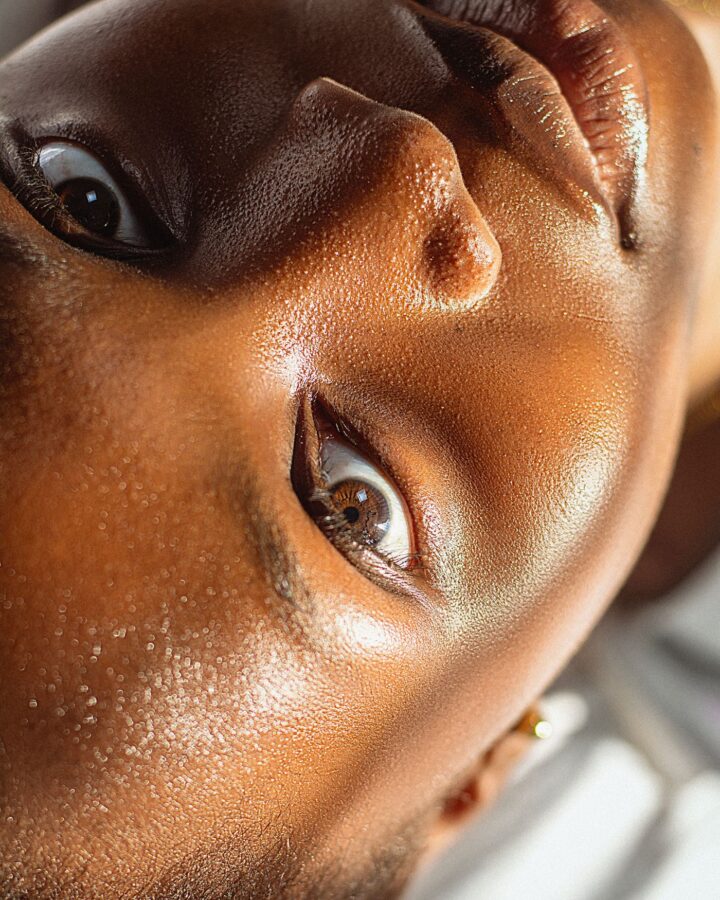 Primer plano de piel con luz cálida — láser médico facial