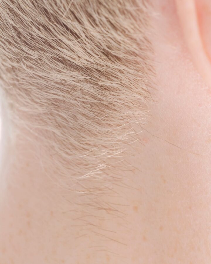 Densidad capilar natural — micropigmentación capilar