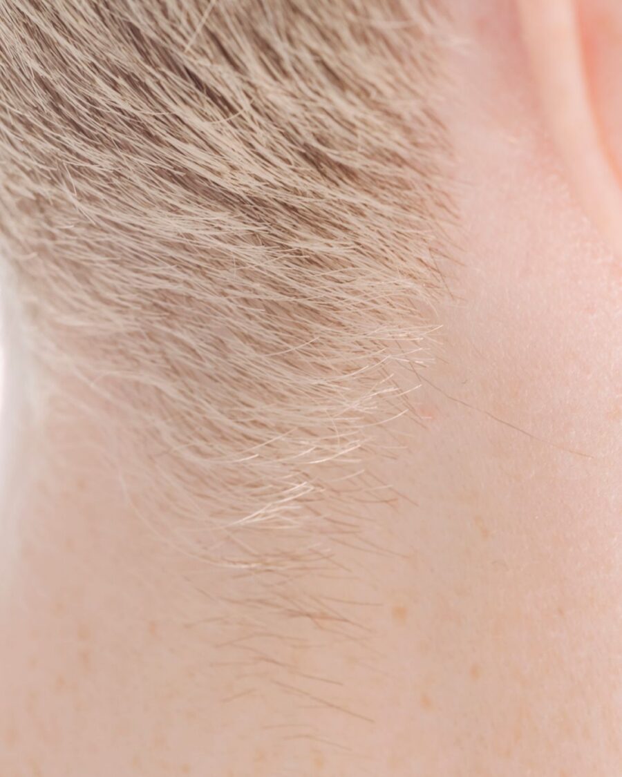 Densidad capilar natural — micropigmentación capilar