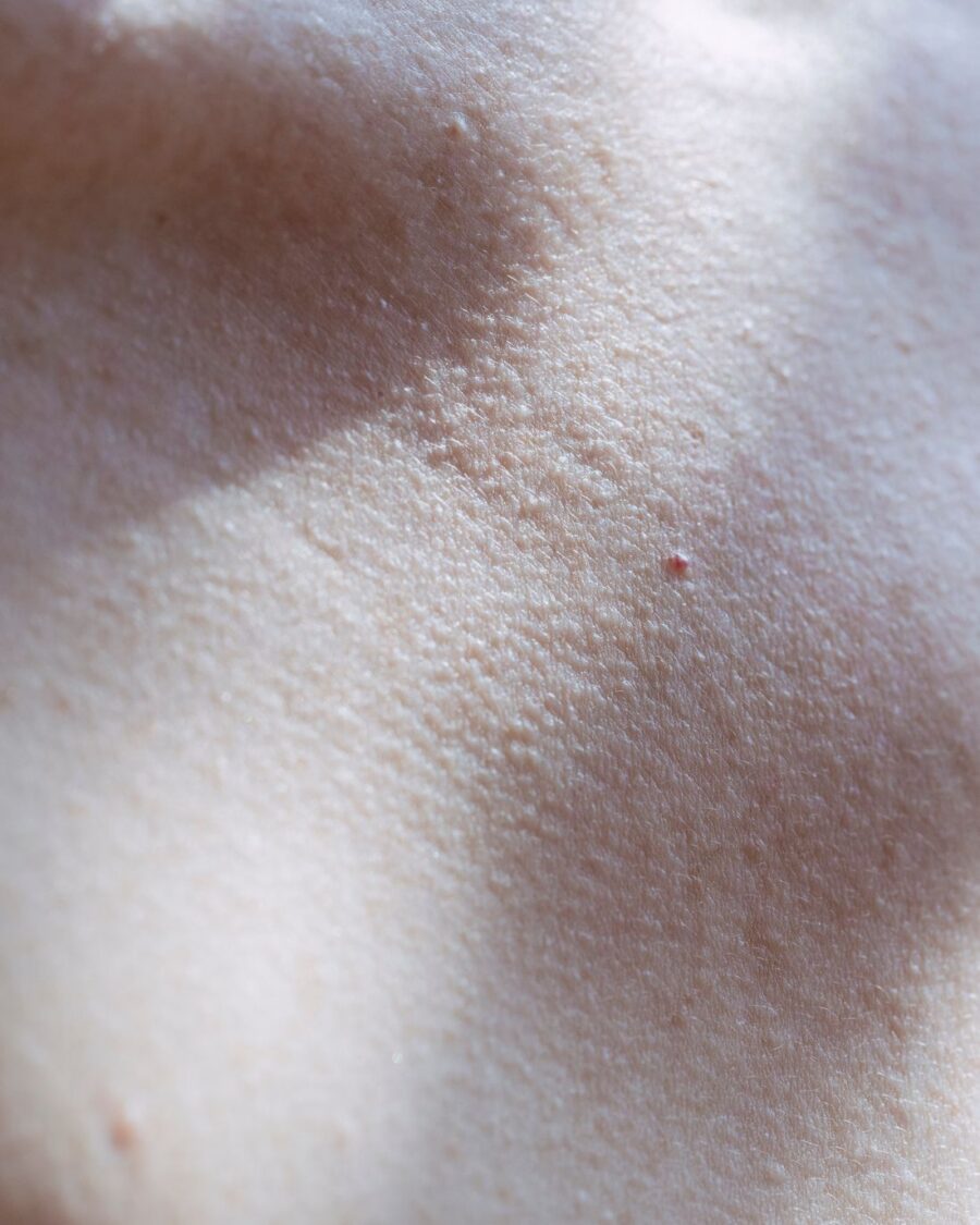 Textura de piel cuidada — intralipoterapia reductora